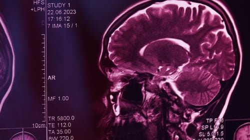 Q&A: Advancing the Public Health Approach to Suicide Prevention for the VA and DoD