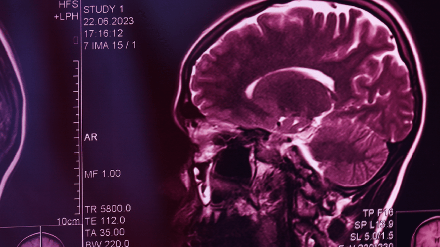 Q&A: Advancing the Public Health Approach to Suicide Prevention for the VA and DoD